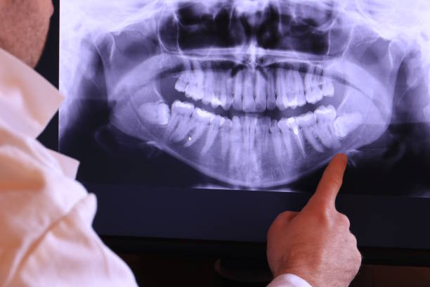 Best Emergency Denture Repair in Mount Angel, OR