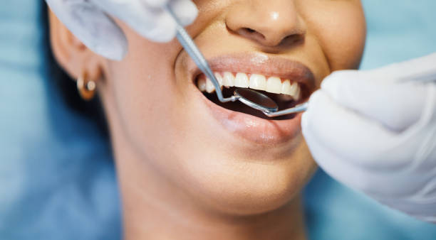 Best Emergency Treatment for Dental Infections or Abscesses in Mount Angel, OR